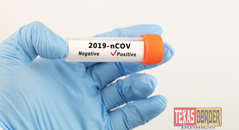 Thirty-four people die with COVID-19 complications; 524 people test positive
