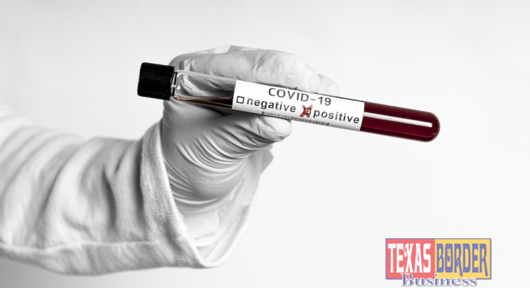 Thirty-five more people die of COVID-19 complications; 651 test positive