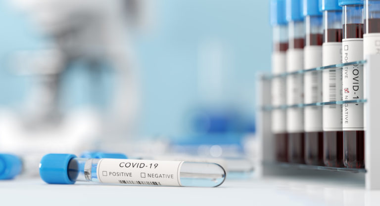 Five more deaths and 171 new cases related to COVID-19 reported in Hidalgo County