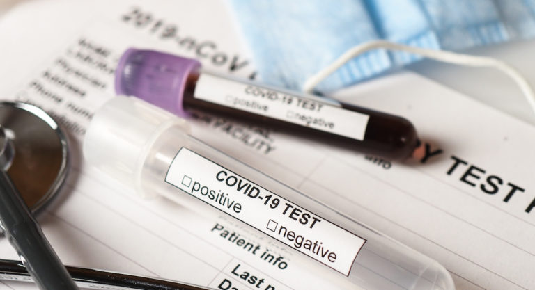 Four more deaths related to COVID-19 reported in Hidalgo County along with 763 positive cases