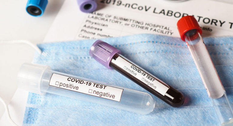 Five more die of COVID-19 related causes in Hidalgo County; 183 more positive cases