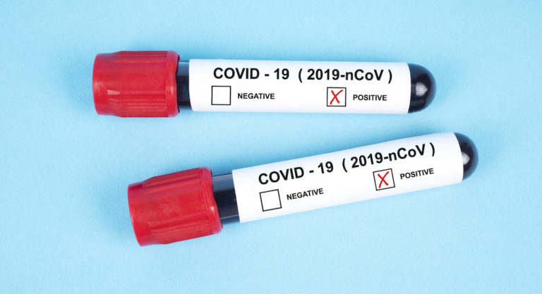 Two more deaths related to COVID-19 reported in Hidalgo County along with 612 positive cases