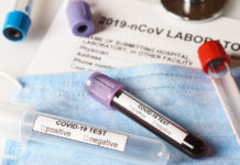 Six more deaths related to COVID-19 reported in Hidalgo County along with 285 positive cases