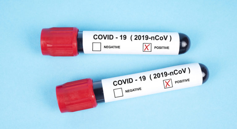 Five deaths related to COVID-19 reported in Hidalgo County along with 505 positive cases