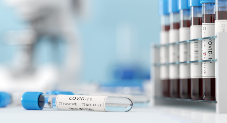 Five more deaths related to COVID-19 reported in Hidalgo County along with 386 positive cases