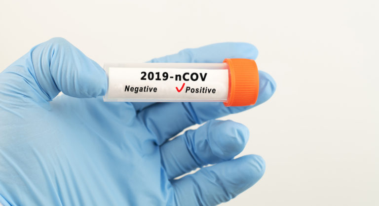 Eighteen deaths related to COVID-19 reported in Hidalgo County along with 739 positive cases