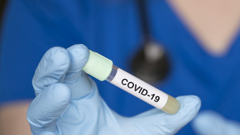 Nine Deaths Related to COVID-19 reported in Hidalgo County along with 510 positive cases