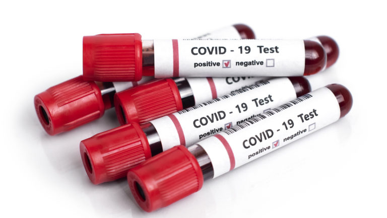 Thirteen deaths related to COVID-19 reported in Hidalgo County along with 733 positive cases