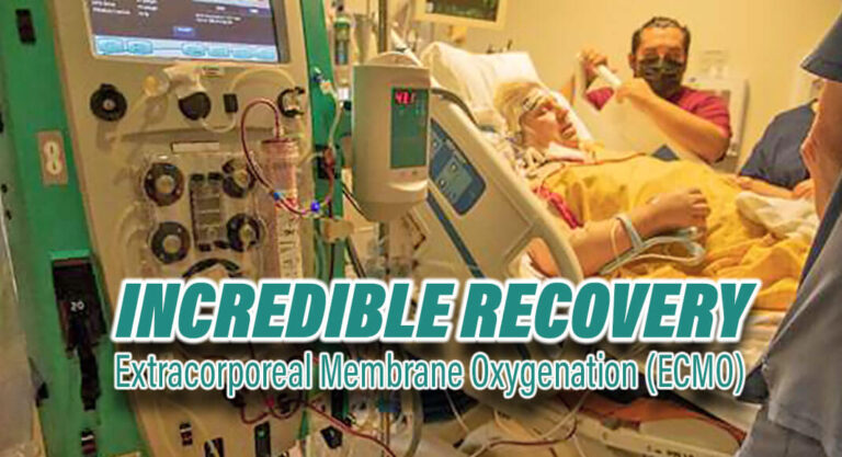 First Patient to Receive ECMO Treatment In RGV Makes Incredible Recovery
