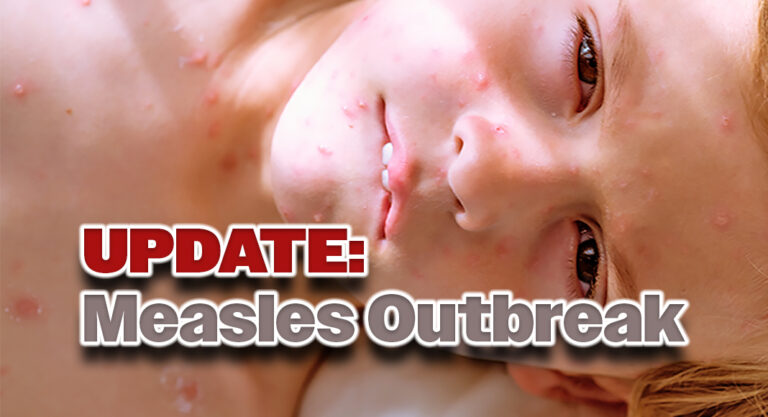 UPDATE: Measles Outbreak