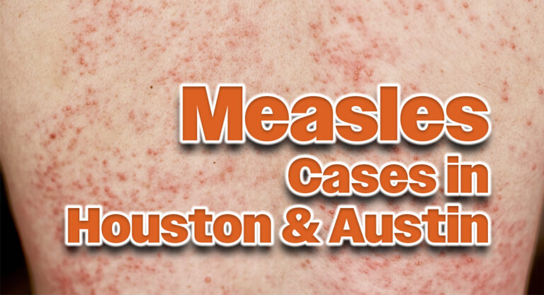 Houston and Austin Report New Measles Cases Within Statewide Outbreak