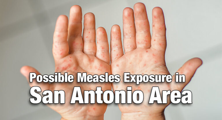Health Officials Warn of Possible Measles Exposure in San Antonio Area