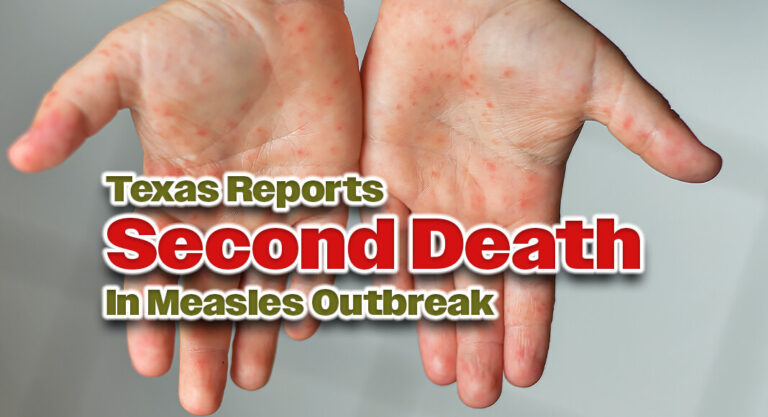 Second Death Reported In Measles Outbreak In Texas